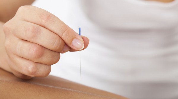 Hand Stimulating Acupuncture Needle